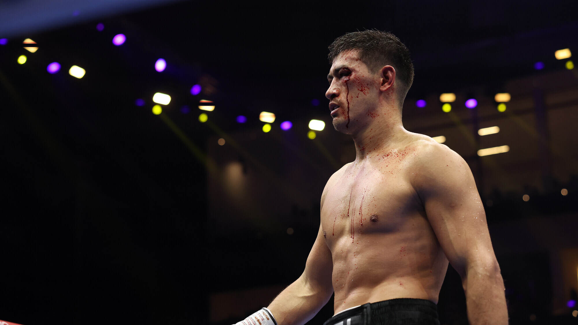 Дмитро Бивол звернувся до IBF з проханням про медичну відстрочку захисту титулу